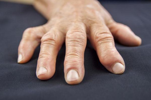 風(fēng)濕病可以天天洗澡嗎 風(fēng)濕病可以吃蝦嗎 風(fēng)濕病可以天天洗澡嗎 風(fēng)濕病可以吃蝦嗎