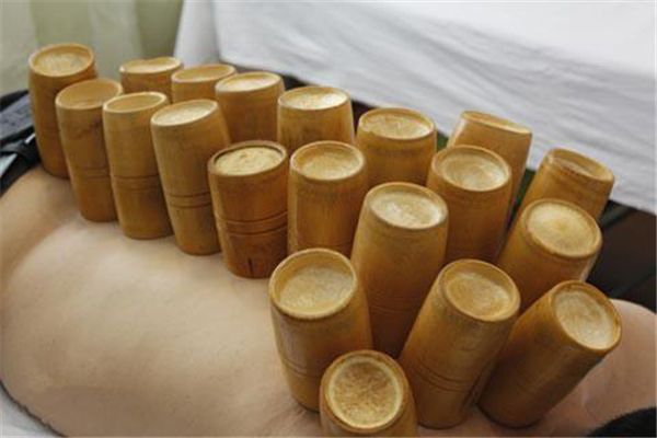 拔罐可以減肥嗎 拔罐有什么功效和作用 拔罐可以減肥嗎 拔罐有什么功效和作用