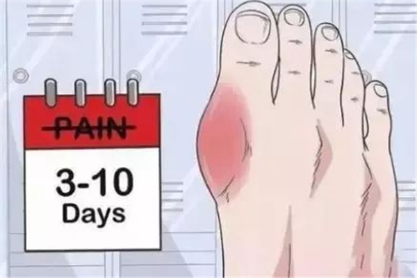 尿酸高對腎功能有影響嗎 尿酸高對腎功能有哪些影響 尿酸高對腎功能有影響嗎 尿酸高對腎功能有哪些影響