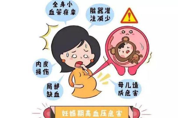 孕期高血壓怎么降下來(lái) 孕期高血壓是怎么引起的