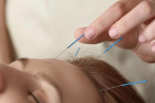 針灸有危險(xiǎn)嗎 針灸有什么好處和壞處 針灸有危險(xiǎn)嗎 針灸有什么好處和壞處
