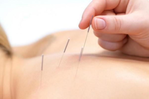針灸對(duì)腰椎間盤(pán)突出有用嗎 針灸對(duì)頸椎病有效果嗎