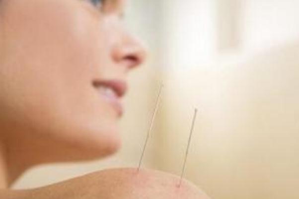 針灸可以去濕氣嗎 針灸可以每天做嗎 針灸可以去濕氣嗎 針灸可以每天做嗎