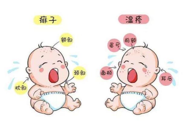 寶寶濕疹反反復(fù)復(fù)怎么根除 寶寶濕疹反復(fù)不斷是什么原因 寶寶濕疹反反復(fù)復(fù)怎么根除 寶寶濕疹反復(fù)不斷是什么原因