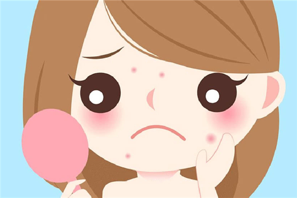 上火會長痘痘嗎 上火長痘痘怎么調(diào)理