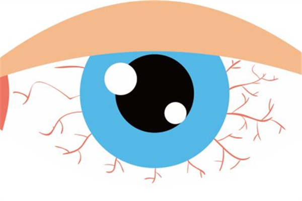 眼睛里有血絲怎么消除 眼睛里有血絲有什么危害 眼睛里有血絲怎么消除 眼睛里有血絲有什么危害