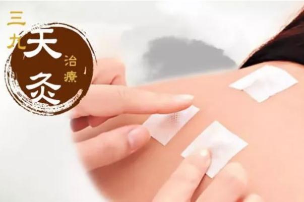 三九貼要注意什么 三九貼要貼多長時(shí)間