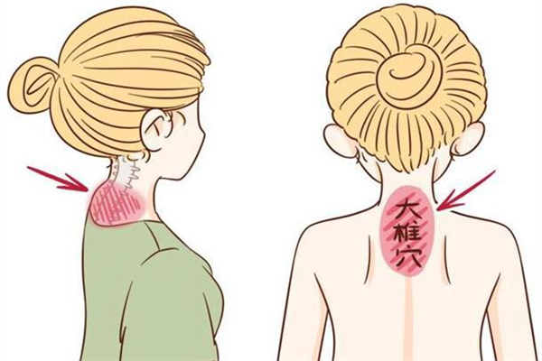 富貴包會造成手腳發(fā)麻嗎 富貴包導致手麻怎么辦 富貴包會造成手腳發(fā)麻嗎 富貴包導致手麻怎么辦