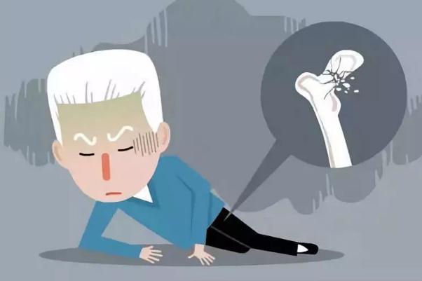 骨質疏松是缺什么元素 骨質疏松是什么意思 骨質疏松是缺什么元素 骨質疏松是什么意思