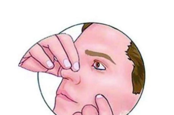 流鼻血有血痰怎么回事 流鼻血有血絲怎么回事 流鼻血有血痰怎么回事 流鼻血有血絲怎么回事