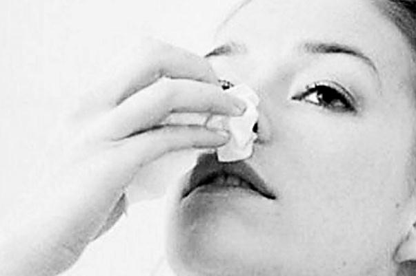 流鼻血有很大粘稠血塊 流鼻血有粘稠血塊怎么辦 流鼻血有很大粘稠血塊 流鼻血有粘稠血塊怎么辦