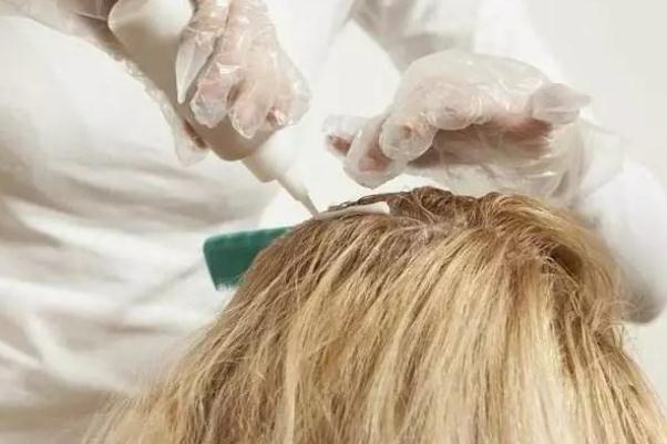 染發(fā)劑過敏會出現(xiàn)什么癥狀 染發(fā)劑過敏了怎么辦 染發(fā)劑過敏會出現(xiàn)什么癥狀 染發(fā)劑過敏了怎么辦