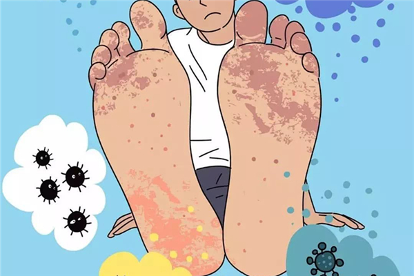 腳氣怎么治療能根除 腳氣是怎么引起的 腳氣怎么治療能根除 腳氣是怎么引起的