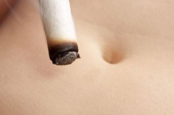 艾灸會導(dǎo)致流產(chǎn)嗎 艾灸對痛風(fēng)有治療作用嗎 艾灸會導(dǎo)致流產(chǎn)嗎 艾灸對痛風(fēng)有治療作用嗎