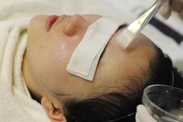 刷酸祛痘效果怎么樣 刷酸祛痘怎么操作 刷酸祛痘效果怎么樣 刷酸祛痘怎么操作