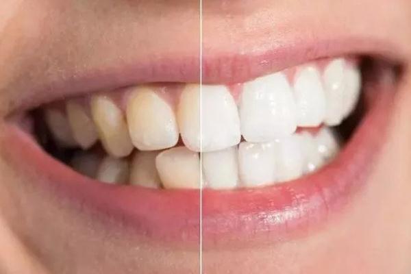 牙黃怎么變白簡(jiǎn)單方法 牙黃是什么原因?qū)е碌?>
               <p class=