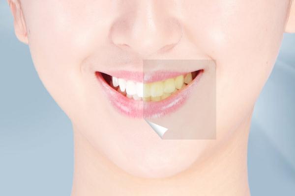 牙黃是身體哪里出問題了 牙齒越來(lái)越黃怎么回事