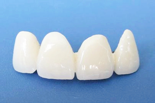 烤瓷牙會(huì)導(dǎo)致臉變形嗎 烤瓷牙會(huì)導(dǎo)致牙齦萎縮嗎 烤瓷牙會(huì)導(dǎo)致臉變形嗎 烤瓷牙會(huì)導(dǎo)致牙齦萎縮嗎