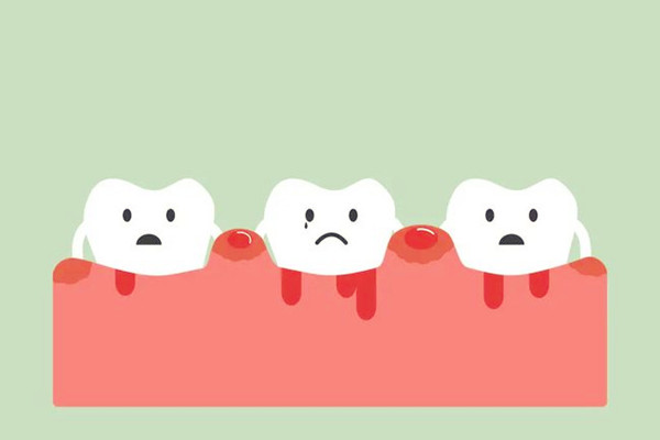 烤瓷牙會(huì)導(dǎo)致臉變形嗎 烤瓷牙會(huì)導(dǎo)致牙齦萎縮嗎 烤瓷牙會(huì)導(dǎo)致臉變形嗎 烤瓷牙會(huì)導(dǎo)致牙齦萎縮嗎
