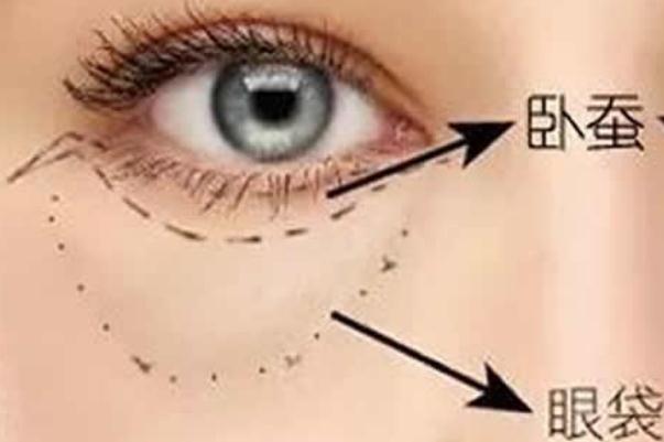 眼袋是脾虛引起的嗎 眼袋是哪個經絡堵塞