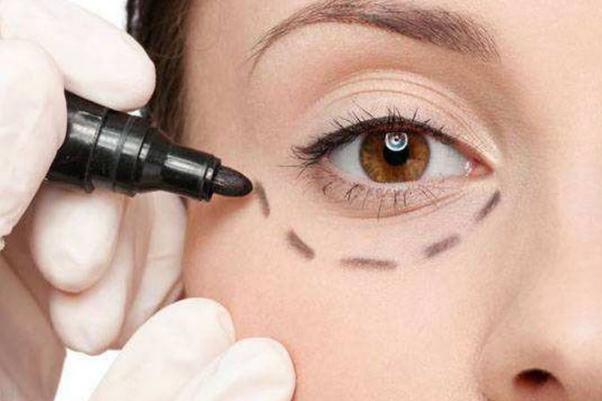 眼袋會(huì)不會(huì)遺傳 眼袋能自然消除嗎 眼袋會(huì)不會(huì)遺傳 眼袋能自然消除嗎