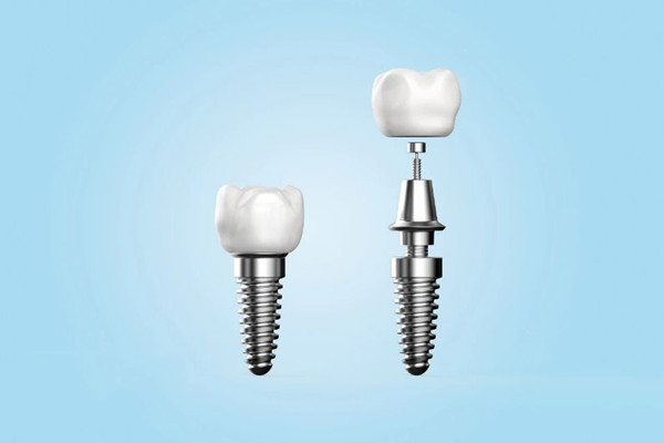 種植牙如何護(hù)理 種植牙會有后遺癥嗎