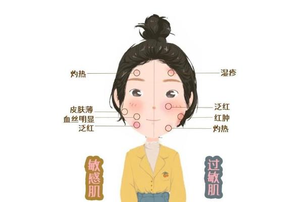 敏感肌膚的癥狀有哪些 敏感肌膚的特點(diǎn) 敏感肌膚的癥狀有哪些 敏感肌膚的特點(diǎn)