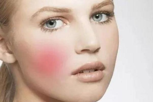 敏感肌要用清潔面膜嗎 敏感肌會自己恢復(fù)嗎