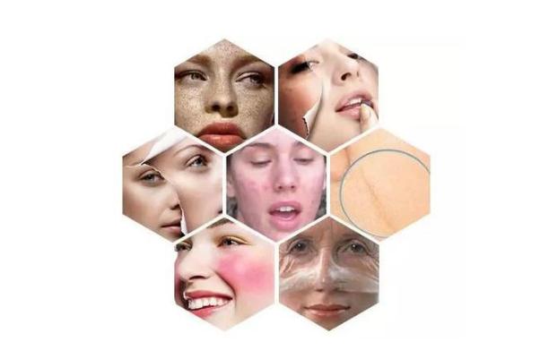 敏感肌膚的癥狀有哪些 敏感肌膚的特點(diǎn) 敏感肌膚的癥狀有哪些 敏感肌膚的特點(diǎn)