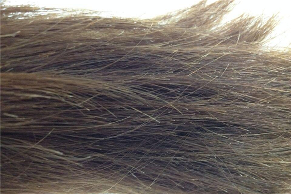 頭發(fā)有分叉會(huì)不會(huì)影響頭發(fā)的生長(zhǎng) 頭發(fā)有分叉的原因