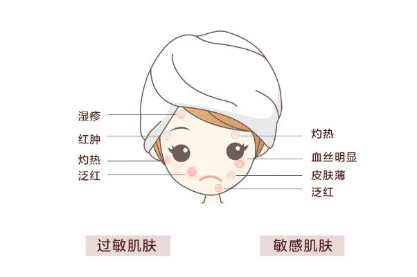 敏感肌怎樣修復成正常肌膚 敏感肌膚適合什么牌子的護膚品 敏感肌怎樣修復成正常肌膚 敏感肌膚適合什么牌子的護膚品