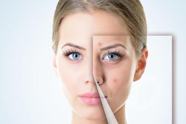 敏感肌膚的癥狀有哪些 敏感肌膚的特點(diǎn) 敏感肌膚的癥狀有哪些 敏感肌膚的特點(diǎn)