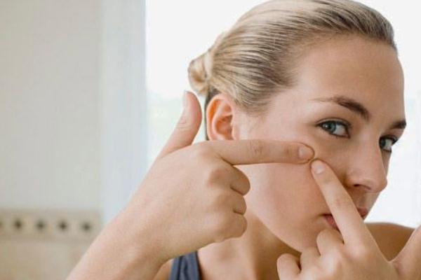 粉刺可以挑出來嗎 粉刺可以自己擠嗎 粉刺可以挑出來嗎 粉刺可以自己擠嗎