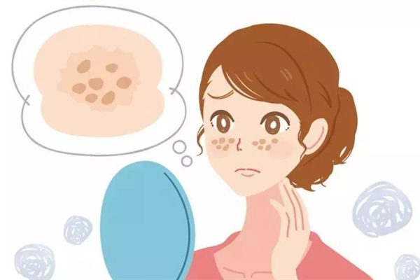 激光祛斑有沒(méi)有后遺癥 激光祛斑會(huì)留下痕跡嗎