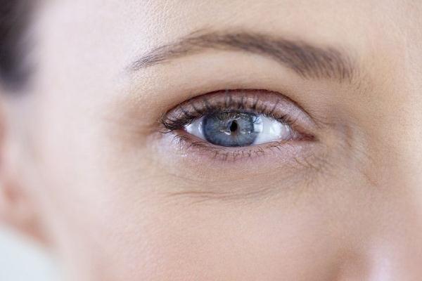 細(xì)紋是怎么產(chǎn)生的 細(xì)紋干紋怎么消除 細(xì)紋是怎么產(chǎn)生的 細(xì)紋干紋怎么消除