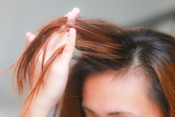 頭發(fā)細軟怎么改善 頭發(fā)細軟適合燙發(fā)嗎