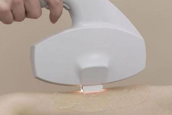 激光脫毛有危害嗎 激光脫毛有輻射嗎 激光脫毛有危害嗎 激光脫毛有輻射嗎