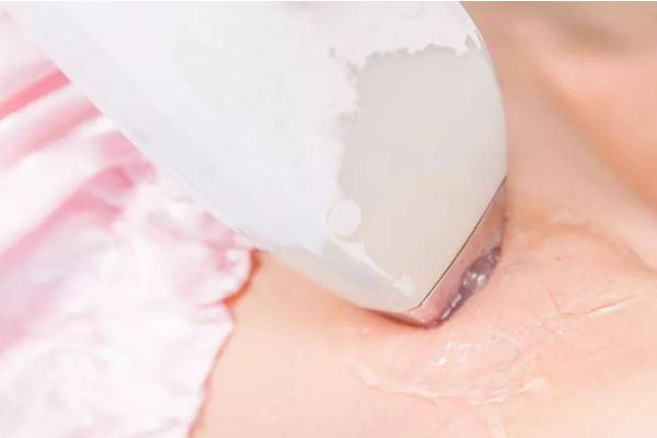 冰點(diǎn)脫毛的光對眼睛有傷害嗎 冰點(diǎn)脫毛會(huì)影響眼睛嗎 冰點(diǎn)脫毛的光對眼睛有傷害嗎 冰點(diǎn)脫毛會(huì)影響眼睛嗎