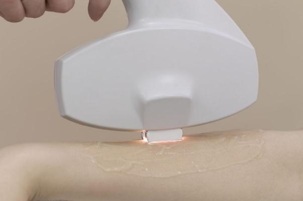 冰點(diǎn)脫毛隔十天能做么 冰點(diǎn)脫毛對身體有沒有傷害 冰點(diǎn)脫毛隔十天能做么 冰點(diǎn)脫毛對身體有沒有傷害