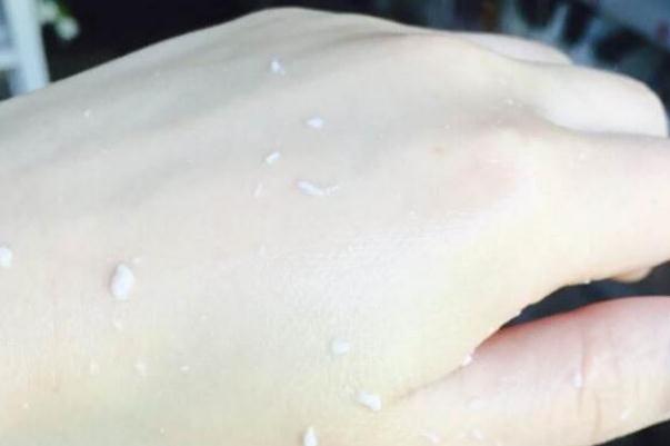 去角質(zhì)有痘痘可以用嗎 去角質(zhì)有副作用嗎 去角質(zhì)有痘痘可以用嗎 去角質(zhì)有副作用嗎