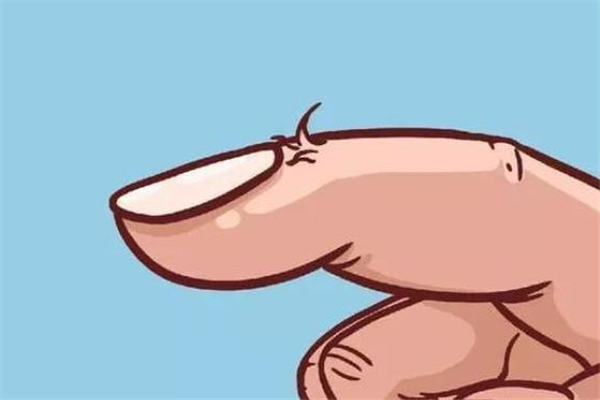 手長倒刺是什么原因造成的 手長倒刺是缺少什么維生素 手長倒刺是什么原因造成的 手長倒刺是缺少什么維生素