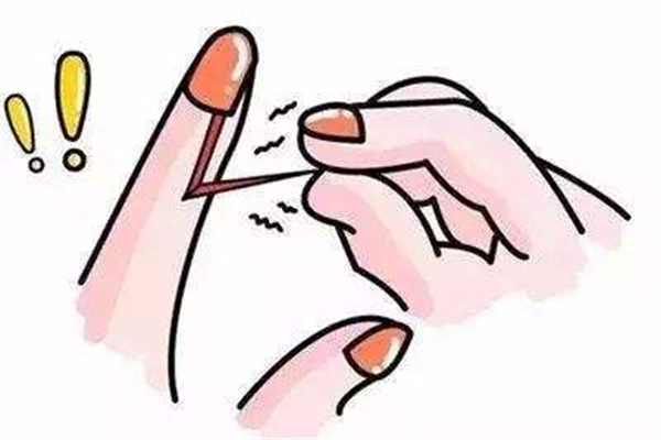 手長倒刺是什么原因造成的 手長倒刺是缺少什么維生素 手長倒刺是什么原因造成的 手長倒刺是缺少什么維生素