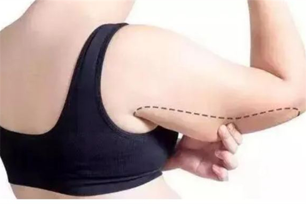 拜拜肉是什么原因造成的 拜拜肉能減掉嗎 拜拜肉是什么原因造成的 拜拜肉能減掉嗎