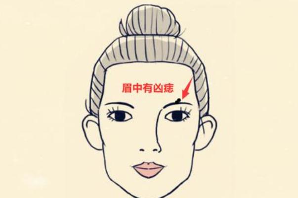 點痣會不會復發(fā) 點痣會留疤留坑嗎 點痣會不會復發(fā) 點痣會留疤留坑嗎