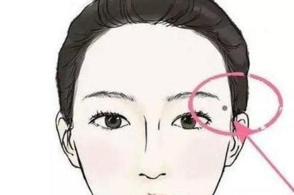 點痣會不會復發(fā) 點痣會留疤留坑嗎 點痣會不會復發(fā) 點痣會留疤留坑嗎