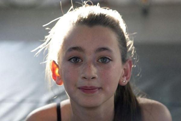 雀斑會變成黃褐斑嗎 雀斑會一直長嗎 雀斑會變成黃褐斑嗎 雀斑會一直長嗎