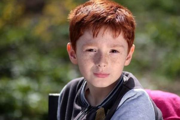 雀斑會變成黃褐斑嗎 雀斑會一直長嗎 雀斑會變成黃褐斑嗎 雀斑會一直長嗎