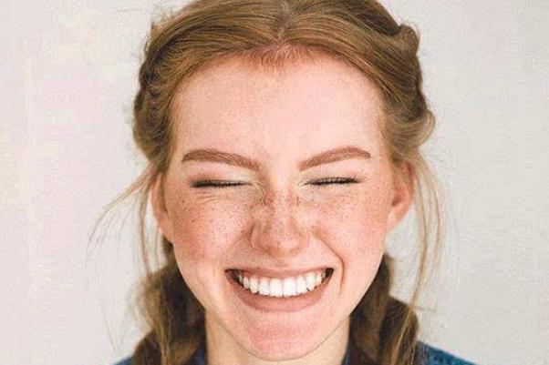 雀斑會變成黃褐斑嗎 雀斑會一直長嗎 雀斑會變成黃褐斑嗎 雀斑會一直長嗎