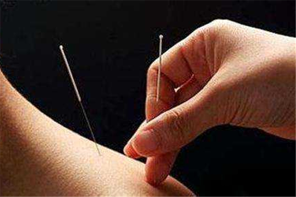 針灸的功效和作用 針灸是什么感覺(jué) 針灸的功效和作用 針灸是什么感覺(jué)