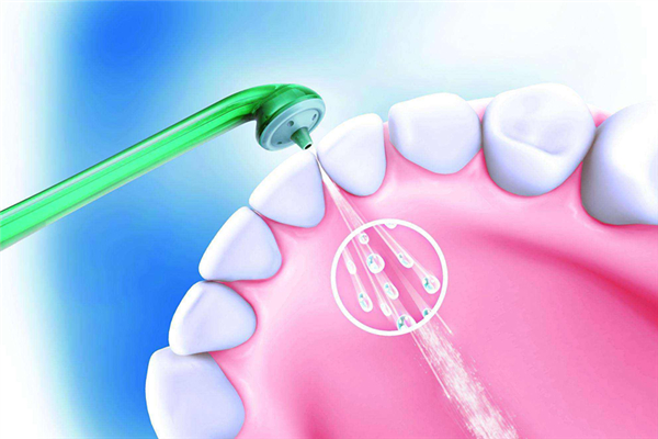 洗牙是掛什么科 洗牙用什么洗的干凈